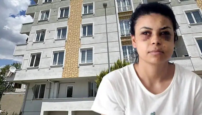 Düğün Töreninde Maganda Dehşeti: Gözde Yaralanma Olur Mu?