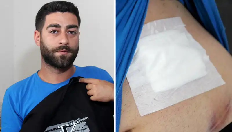 Karnındaki Ağrıların Sebebi Röntgende Ortaya Çıktı: Şok Edici Sonuç